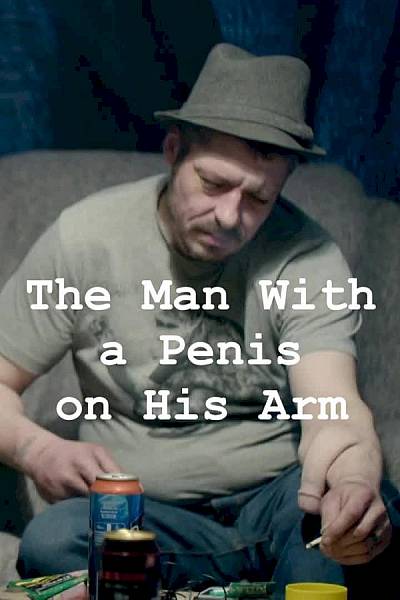 The Man With A Penis On His Arm